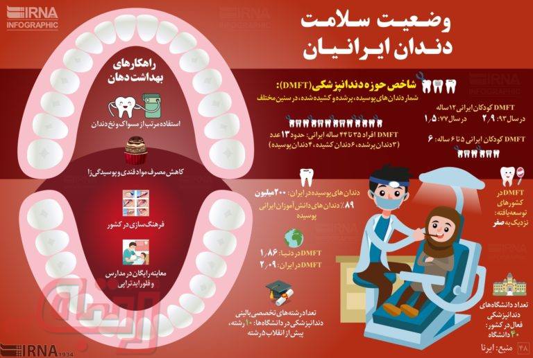 ۲۰۰ میلیون دندان پوسیده در دهان ایرانی‌ها!