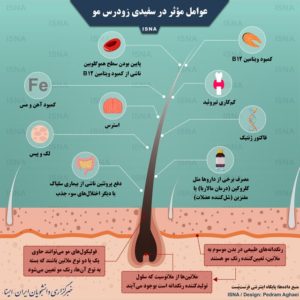 عوامل مؤثر در سفیدی زودرس مو